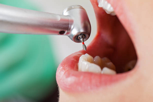 Best Emergency Treatment for Dental Infections or Abscesses in Clarkton, MO